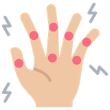Arthritis