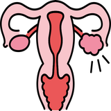 PCOS (PCOD)